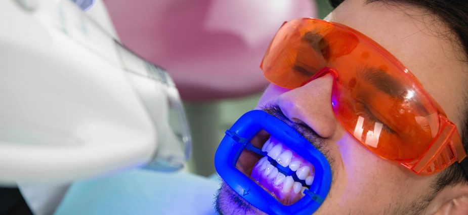 Best Teeth Whitening Services